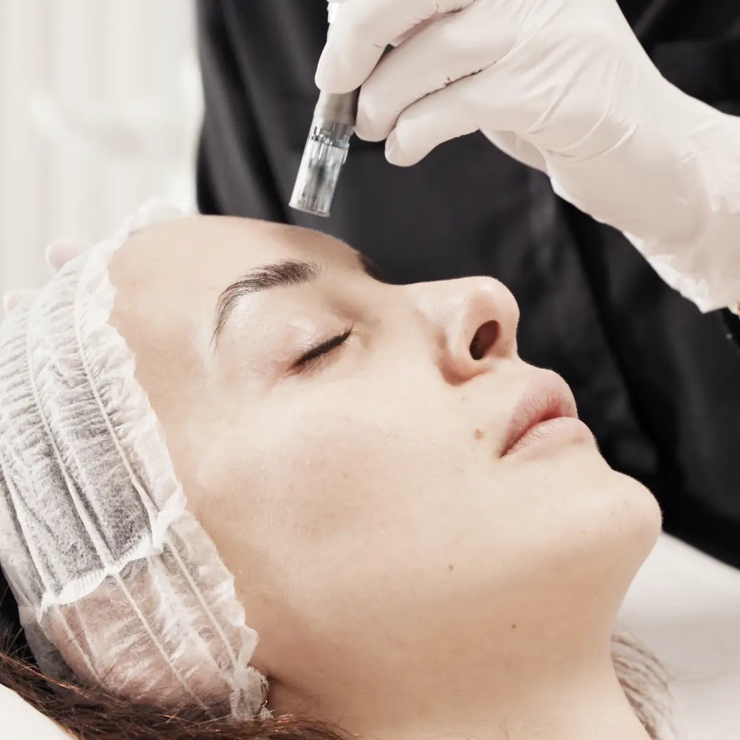 Micro microneedling